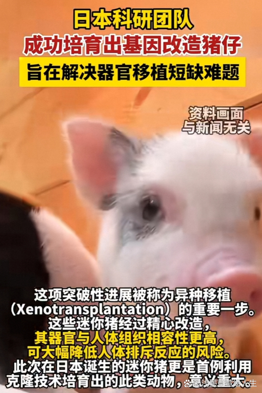 全球首例！中国团队成功将基因编辑猪肝脏移植人体