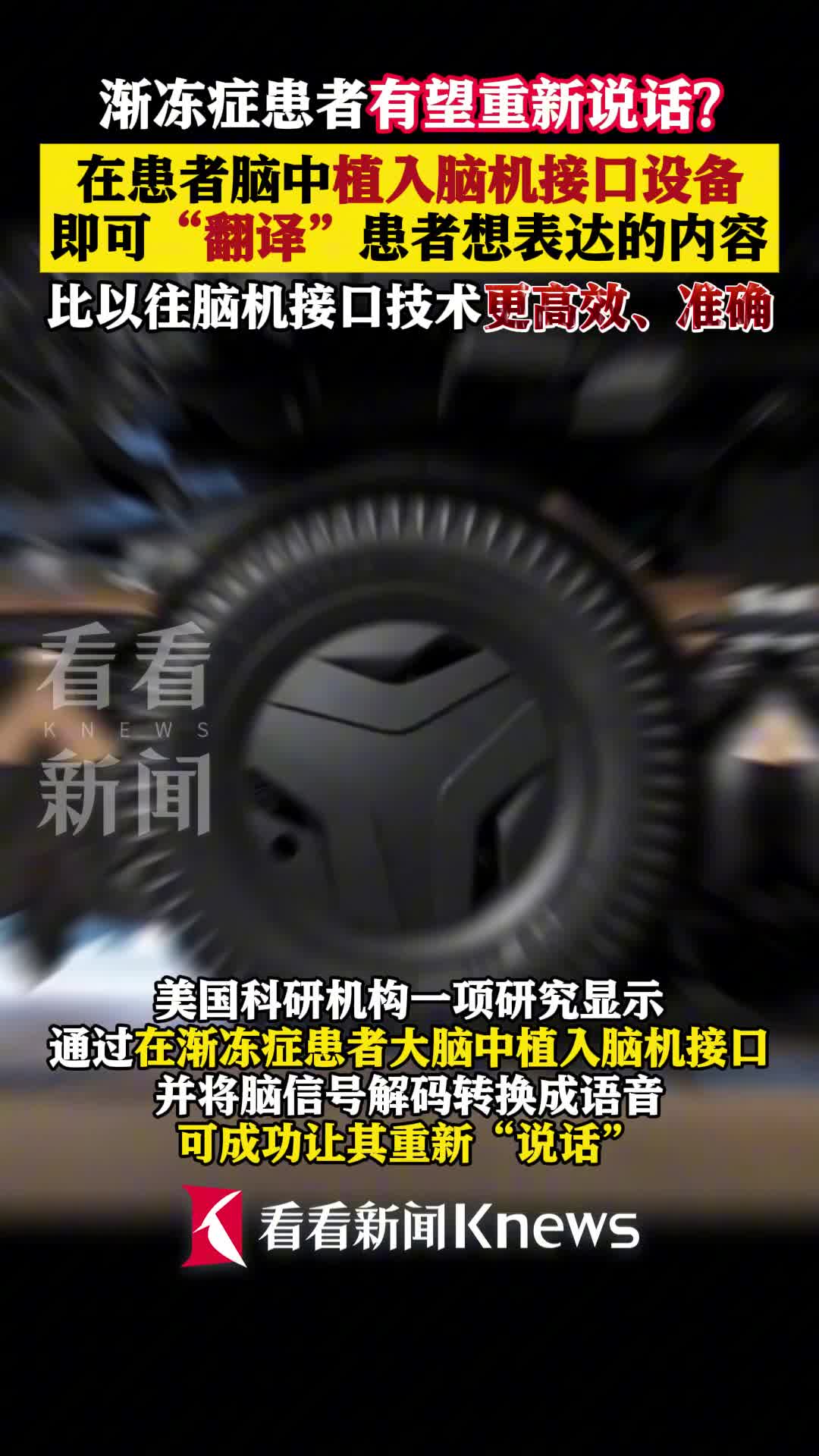 脑机接口技术进入“元年”，投资人直呼“估值太高”