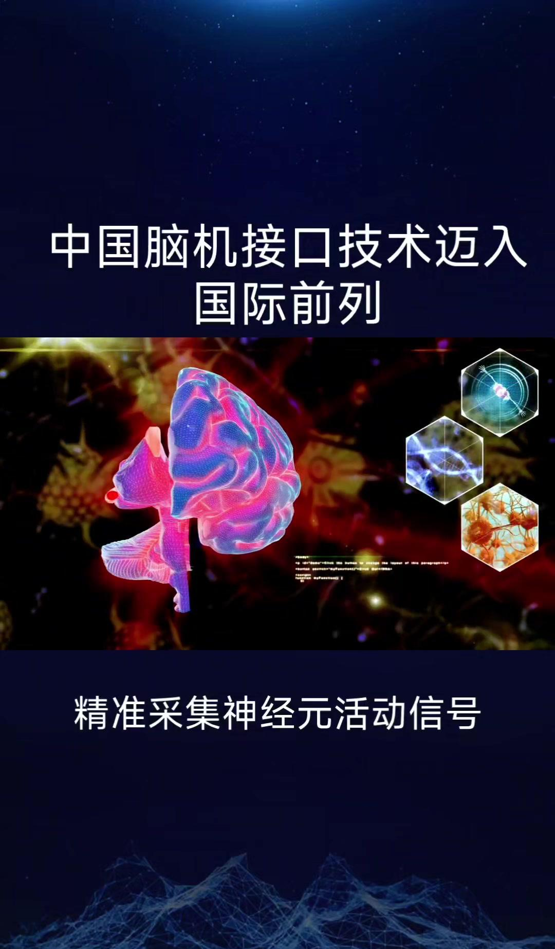 脑机接口技术不断发展，我们准备好了吗