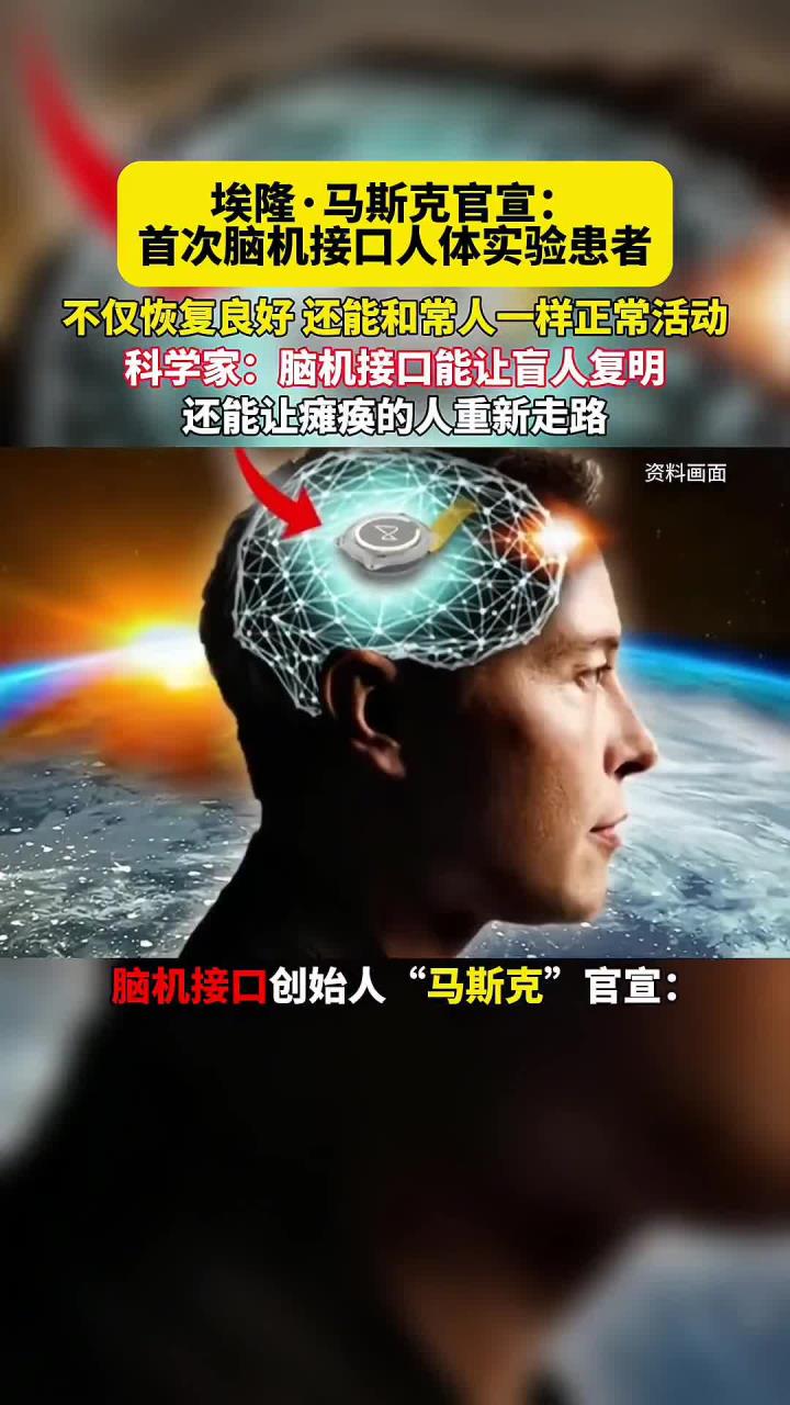 让传感器动起来 我国科研团队研发出脑机接口动态电极